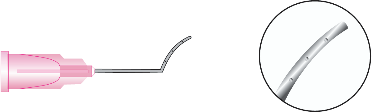 Lasik Cannula (Dr. Anand)